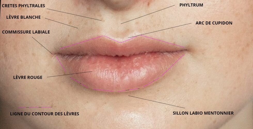 Anatomie de la bouche, reperes pour injection acide hyaluronique levres, Dr Marianne Cayatte Montpellier