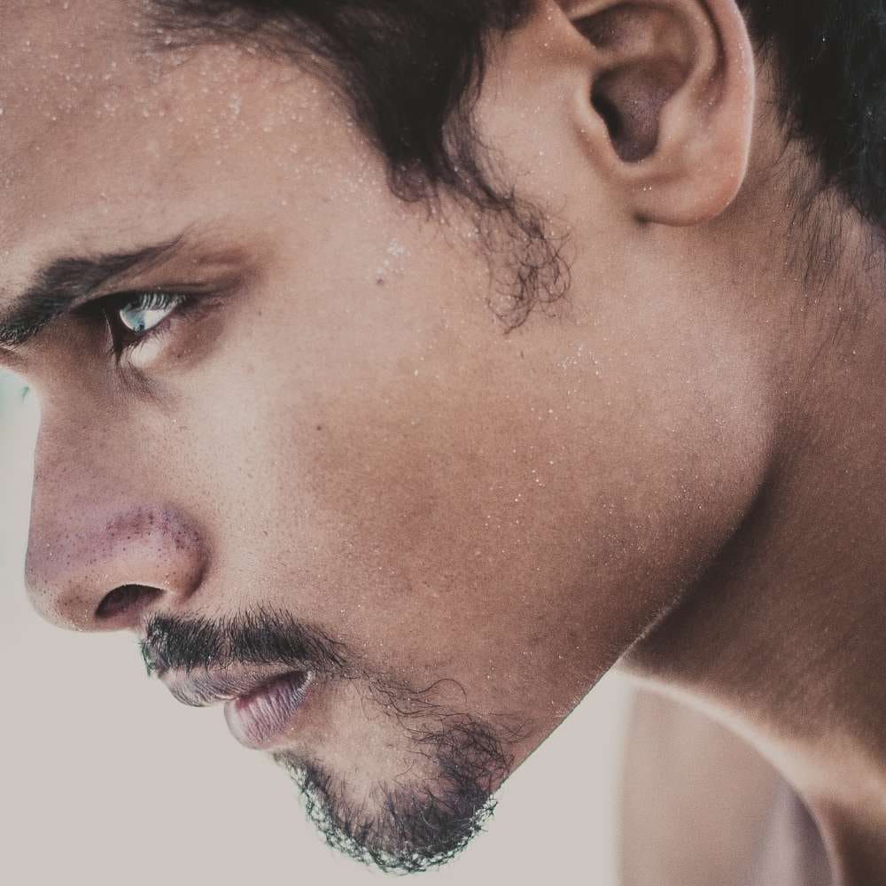 Acide hyaluronique injection homme lèvres · Dr Marianne Cayatte · Montpellier