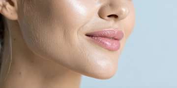 Injection acide hyaluronique menton Montpellier · Dr Marianne Cayatte