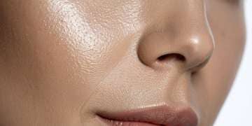 Rhinoplastie médicale acide hyaluronique nez Montpellier · Dr Marianne Cayatte