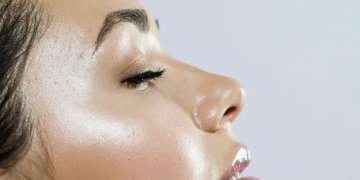 Injection acide hyaluronique tempes Montpellier · Dr Marianne Cayatte
