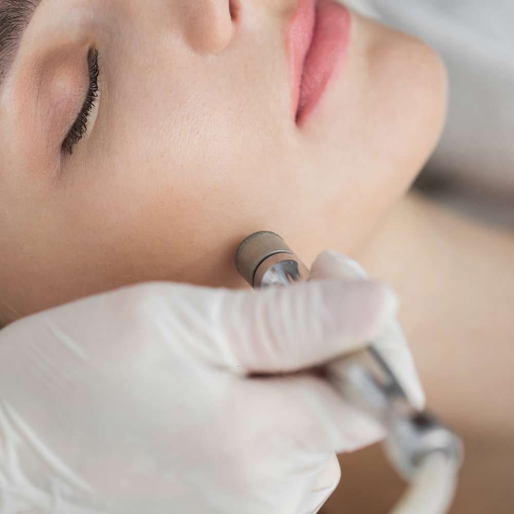 Peeling Moyen · Dr Marianne Cayatte · Montpellier