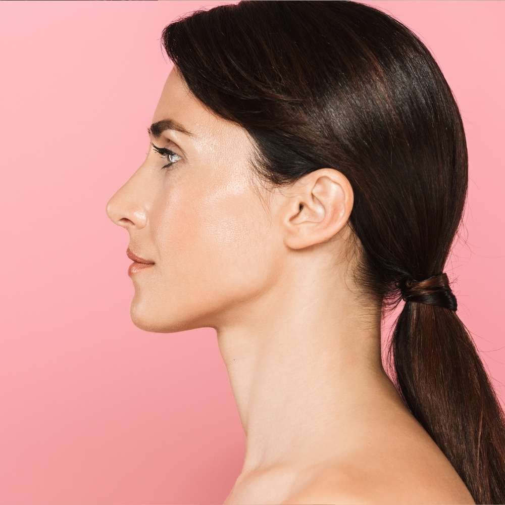 Rhinoplastie médicale profiloplastie profil · Dr Marianne Cayatte · Montpellier