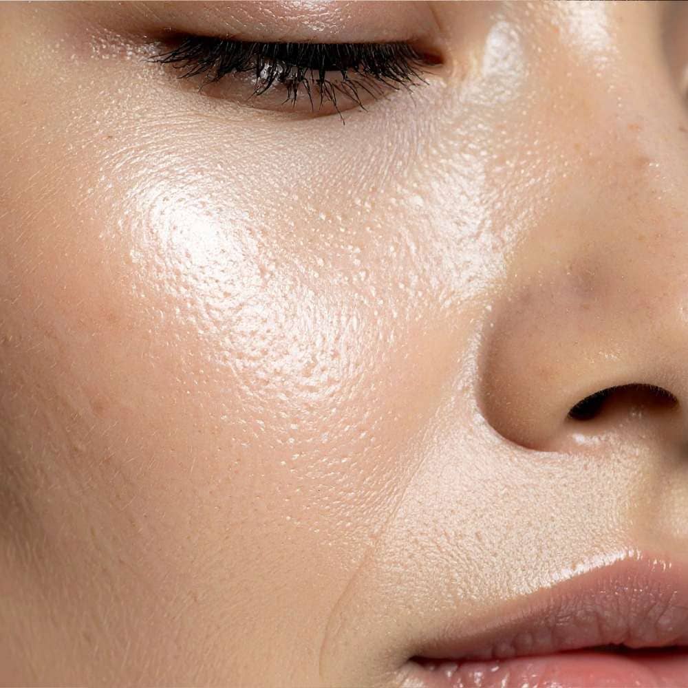 Aquapure Facial pores dilatés · Dr Marianne Cayatte · Montpellier