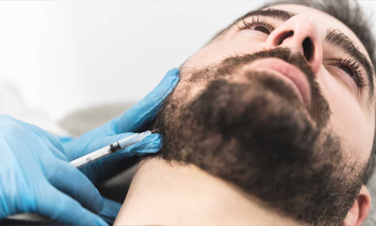 Injection acide hyaluronique mâchoire homme · Dr Cayatte Montpellier